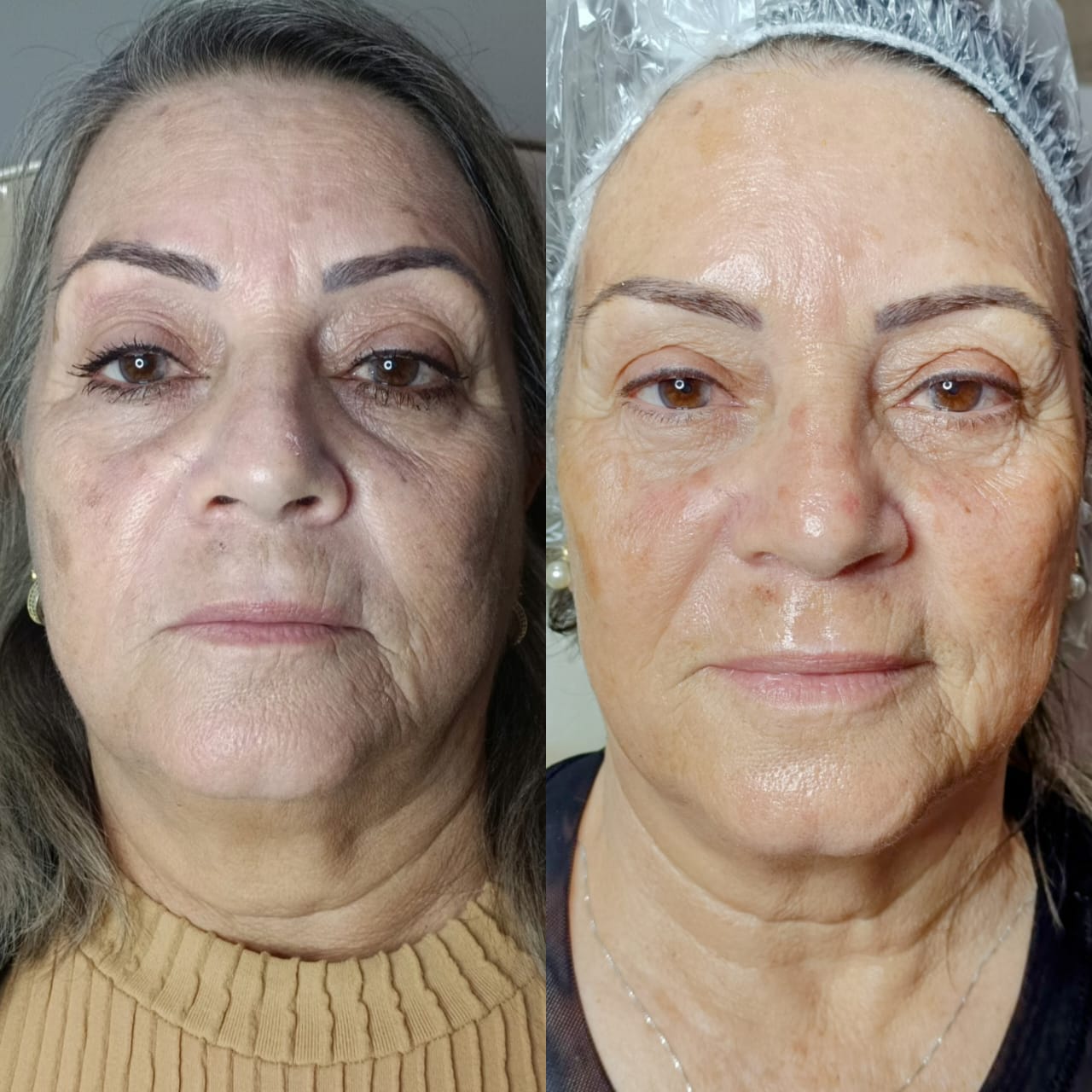 Sutil, Não Artificial